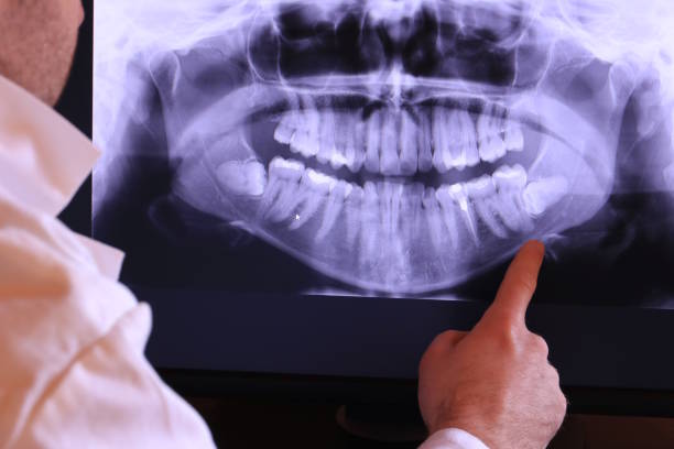 Best Emergency Dental Care for Broken or Chipped Teeth in Robinhood, MS