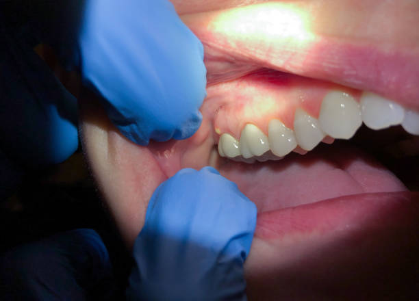 Best Emergency TMJ Treatment in Robinhood, MS